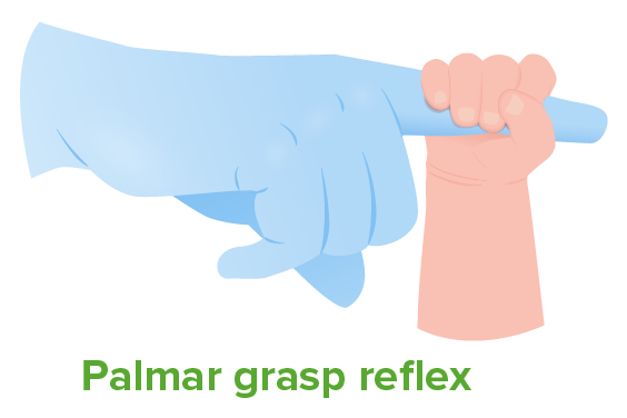 Palmar grasp reflex
